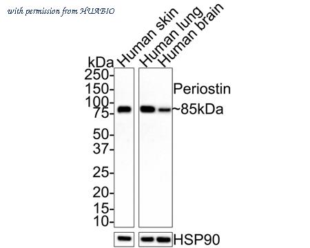HUABIO ET1704-65 image 2