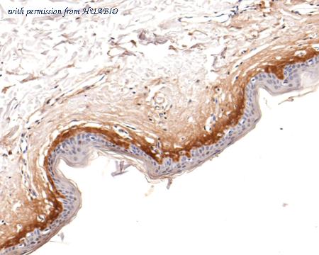 HUABIO ET1704-65 image 3