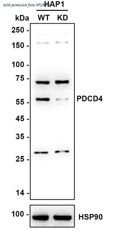 HUABIO ET1704-70 image 1