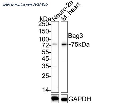 HUABIO ET1704-73 image 1
