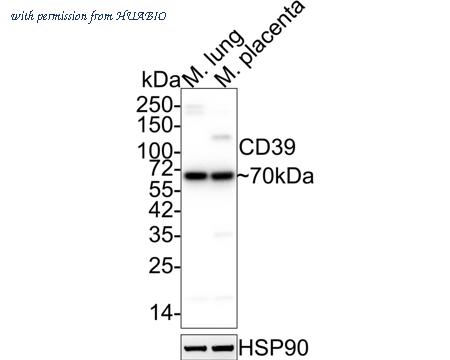 HUABIO ET1704-74 image 1