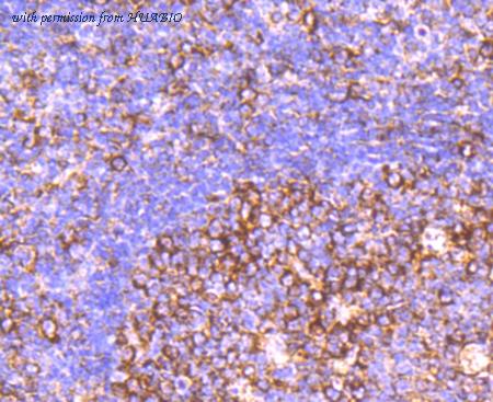 HUABIO ET1704-74 image 2