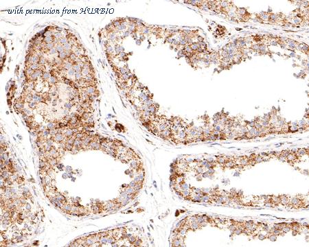 HUABIO ET1704-75 image 1