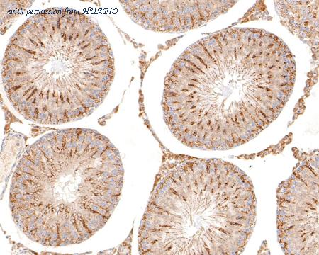 HUABIO ET1704-75 image 2