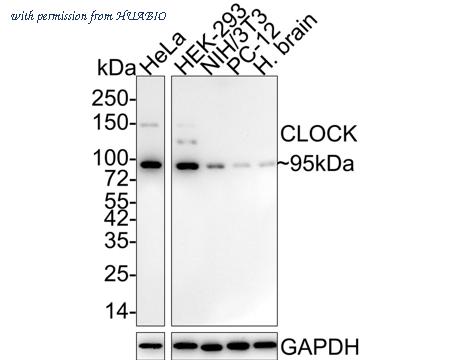 HUABIO ET1704-82 image 1
