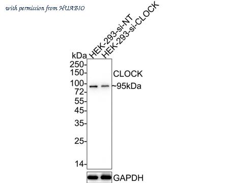 HUABIO ET1704-82 image 2