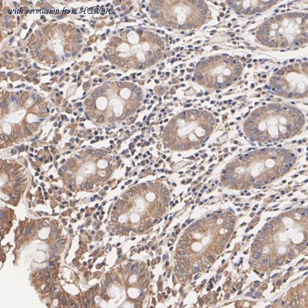 HUABIO ET1704-82 image 3