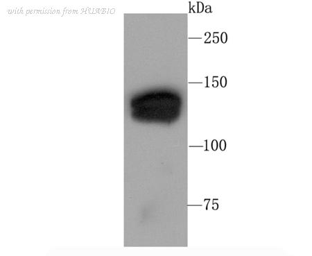 HUABIO ET1704-91 image 1