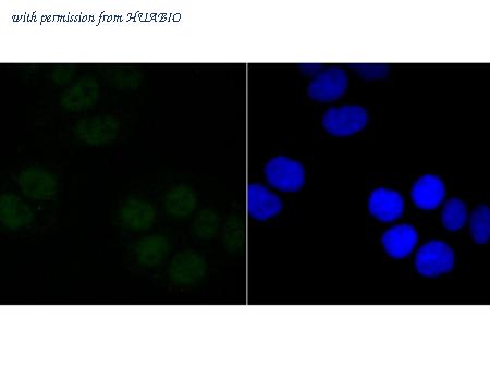 HUABIO ET1704-91 image 2