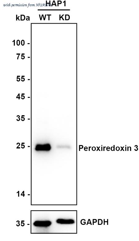 HUABIO ET1704-92 image 1