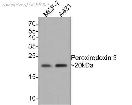 HUABIO ET1704-92 image 2