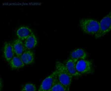 HUABIO ET1704-92 image 3