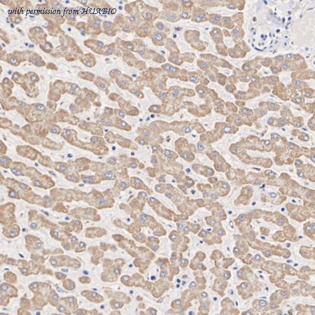 HUABIO ET1704-93 image 3