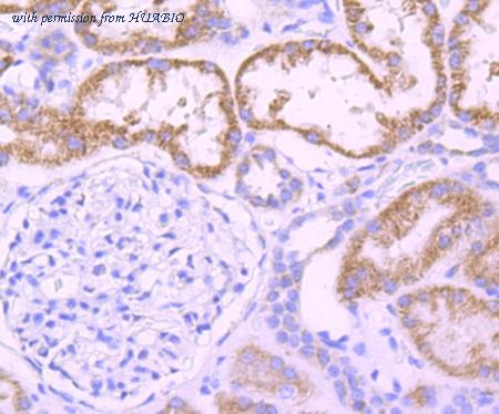 HUABIO ET1704-94 image 1