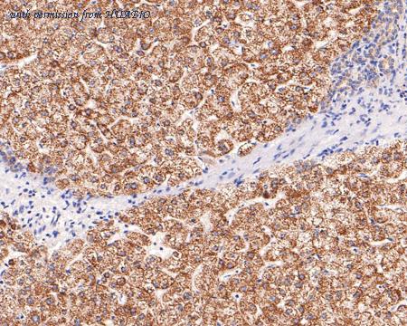 HUABIO ET1704-94 image 2