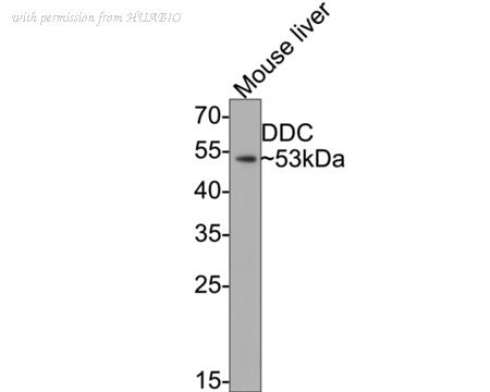 HUABIO ET1704-94 image 3