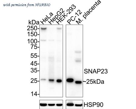 HUABIO ET1704-95 image 1