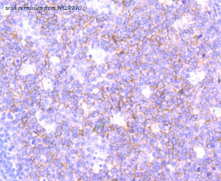 HUABIO ET1704-95 image 2