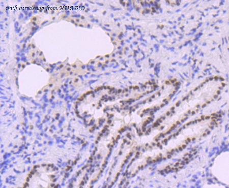 HUABIO ET1705-12 image 3