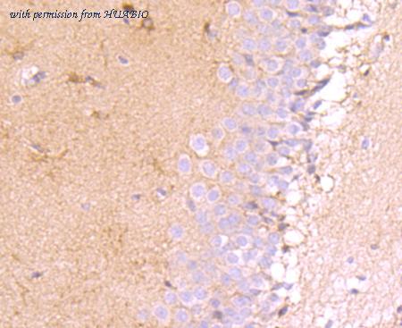 HUABIO ET1705-13 image 1