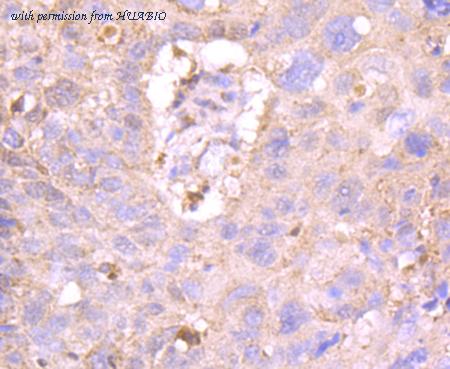 HUABIO ET1705-13 image 2