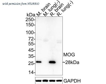 HUABIO ET1705-16 image 1