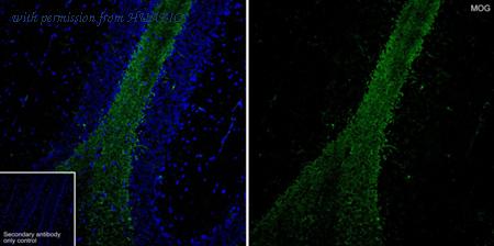 HUABIO ET1705-16 image 2