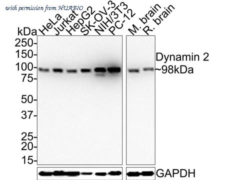 HUABIO ET1705-2 image 1