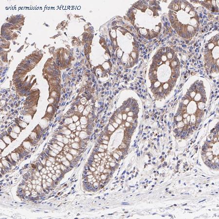 HUABIO ET1705-2 image 3