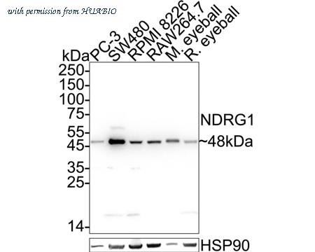 HUABIO ET1705-20 image 1