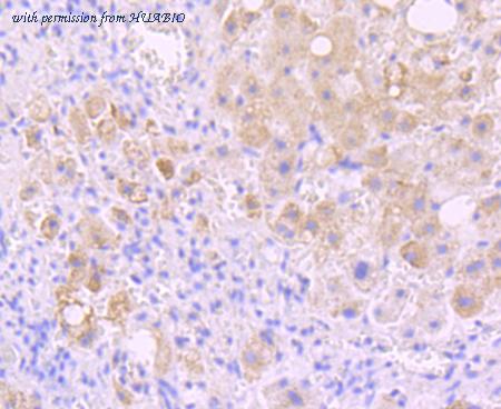 HUABIO ET1705-22 image 1