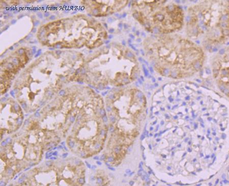 HUABIO ET1705-22 image 3