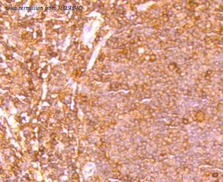 HUABIO ET1705-23 image 2