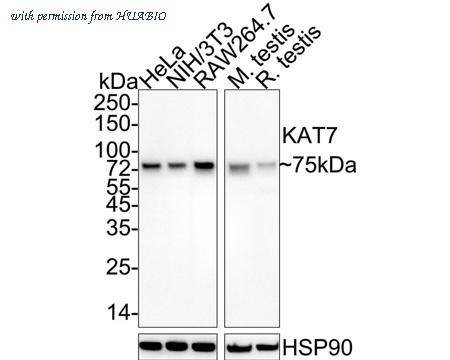 HUABIO ET1705-25 image 1