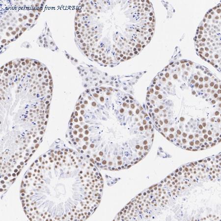 HUABIO ET1705-25 image 2