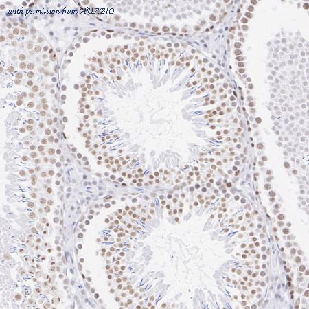 HUABIO ET1705-25 image 3