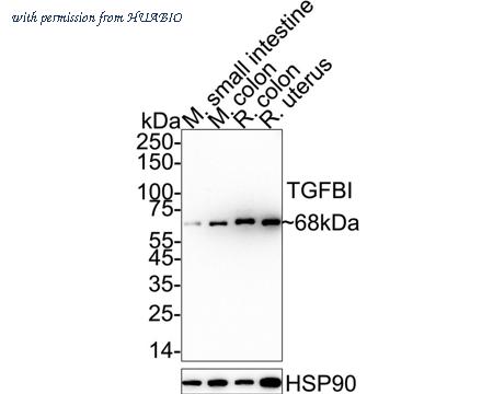 HUABIO ET1705-29 image 1