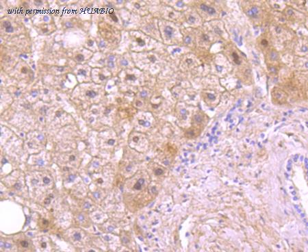 HUABIO ET1705-3 image 3