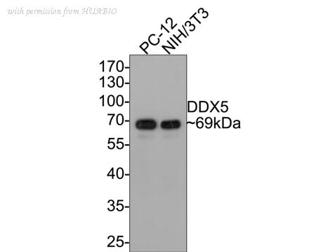 HUABIO ET1705-32 image 1