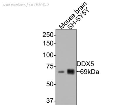 HUABIO ET1705-32 image 2
