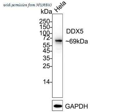 HUABIO ET1705-32 image 3