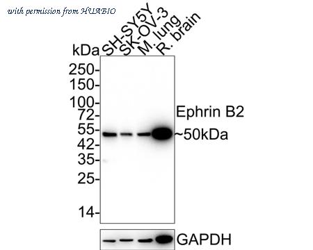 HUABIO ET1705-33-50UL image 1