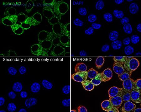 HUABIO ET1705-33-50UL image 3