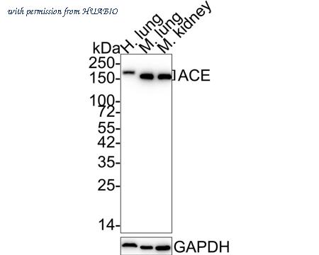 HUABIO ET1705-36-50UL image 1