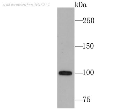 HUABIO ET1705-38 image 1