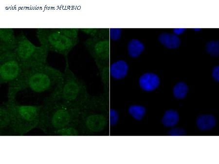 HUABIO ET1705-38 image 2