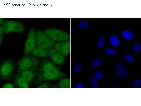 HUABIO ET1705-38 image 3