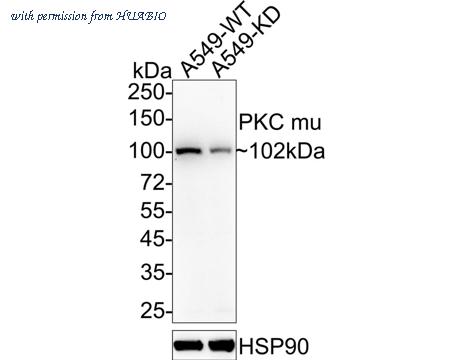 HUABIO ET1705-4 image 1