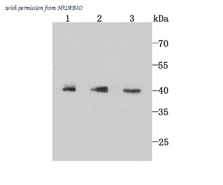 HUABIO ET1705-40 image 1