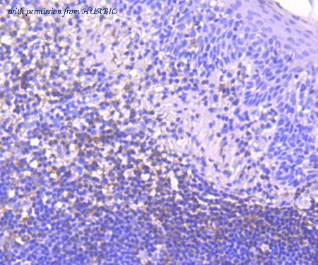 HUABIO ET1705-40 image 2